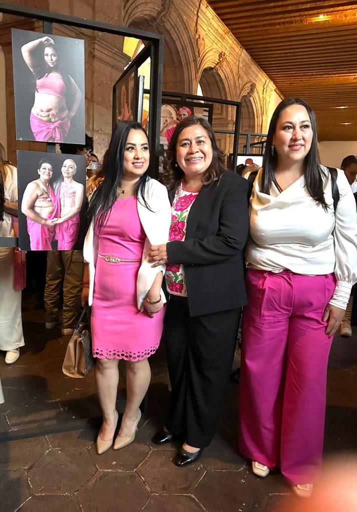 Inauguran exposición fotográfica de “Mujeres Sobrevivientes de Cáncer”