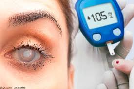 Salud Ocular:                                                  El síntoma silencioso que revela niveles altos de azúcar.